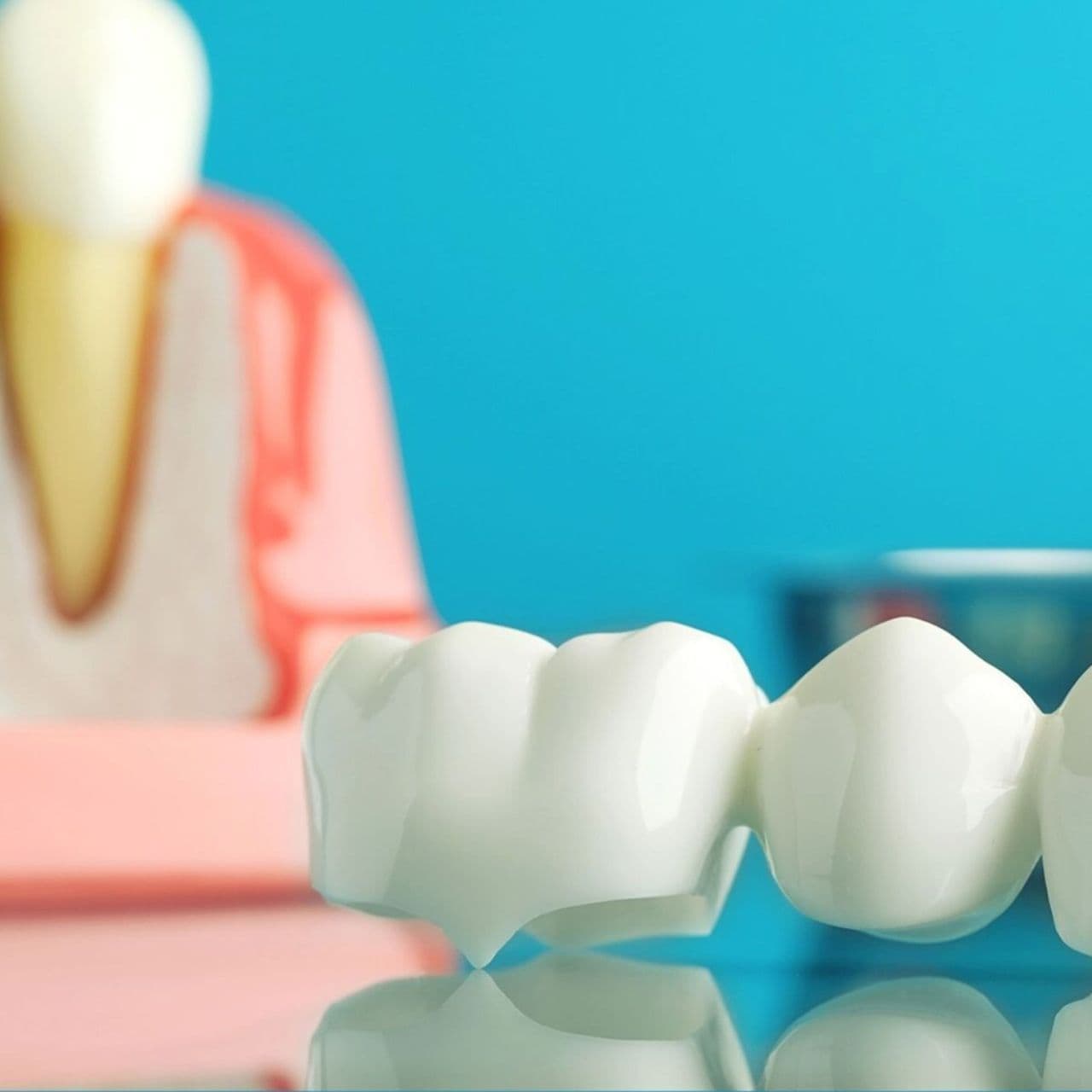Dental bridges at Mount Druitt Dental Care