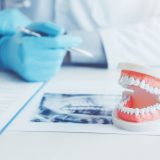 How Can I Book an Appointment With a Local Colyton Dentist
