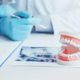 How Can I Book an Appointment With a Local Colyton Dentist